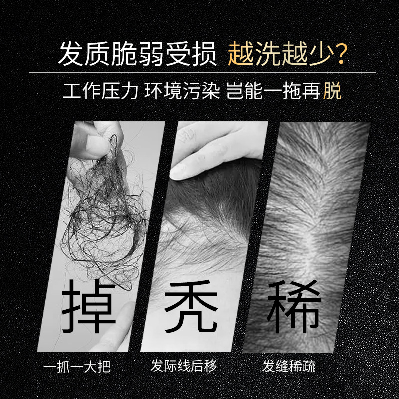 모발 성장 및 두피 관리를 위한 Polygonum Mu - Hair Care Normal 리뷰 및 가격