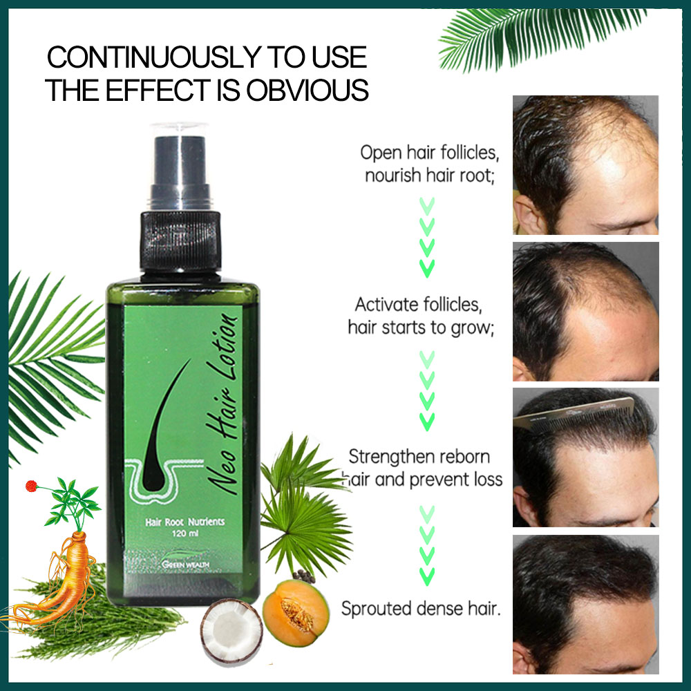 오리지널 네오 헤어 로션 120ml 헤어 케어 모발 뿌 - Hair Care Thailand 리뷰 및 가격