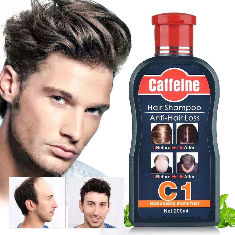 남성용 모발 성장 천연 식물 샴푸, 카페인 탈모 방지, - Hair Care Korean Products 리뷰 및 가격
