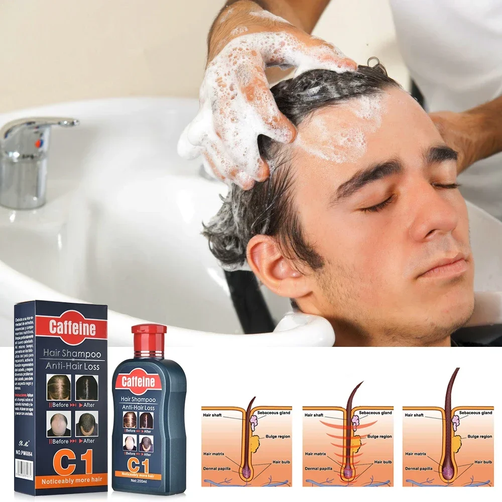 남성용 모발 성장 천연 식물 샴푸, 카페인 탈모 방지, - Hair Care Korean Products 리뷰 및 가격