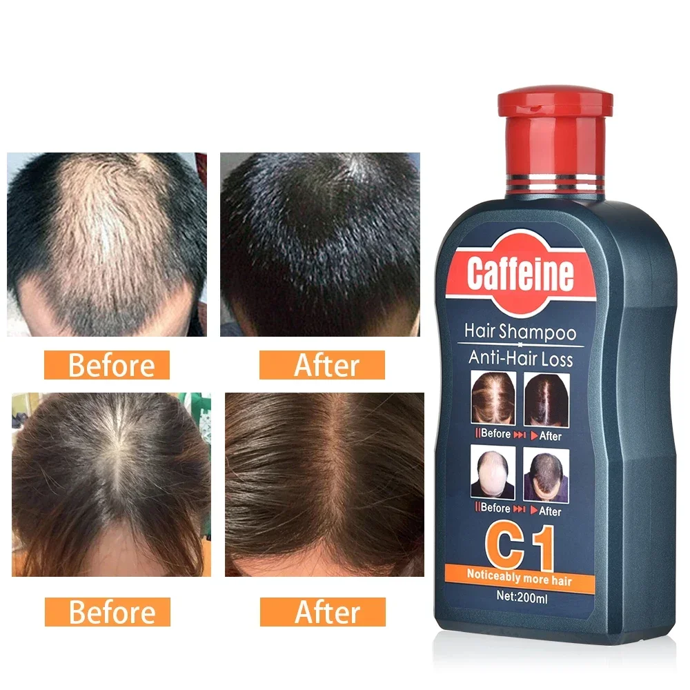 남성용 모발 성장 천연 식물 샴푸, 카페인 탈모 방지, - Hair Care Korean Products 리뷰 및 가격